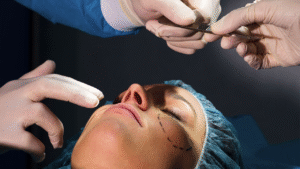 Durango aprueba la ‘Ley Nicole’ para prohibir cirugías estéticas en menores