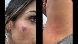 Alcaldesa de Cuauhtémoc denuncia agresión durante operativo