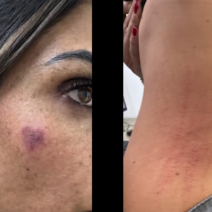 Alcaldesa de Cuauhtémoc denuncia agresión durante operativo