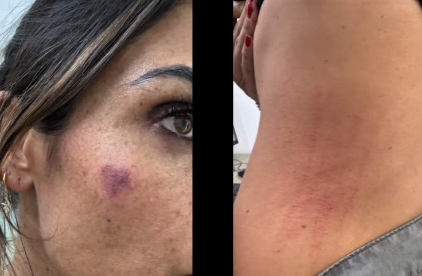 Alcaldesa de Cuauhtémoc denuncia agresión durante operativo