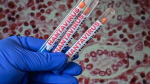 OMS considera de “alto riesgo” a pasajeros infectados por hantavirus